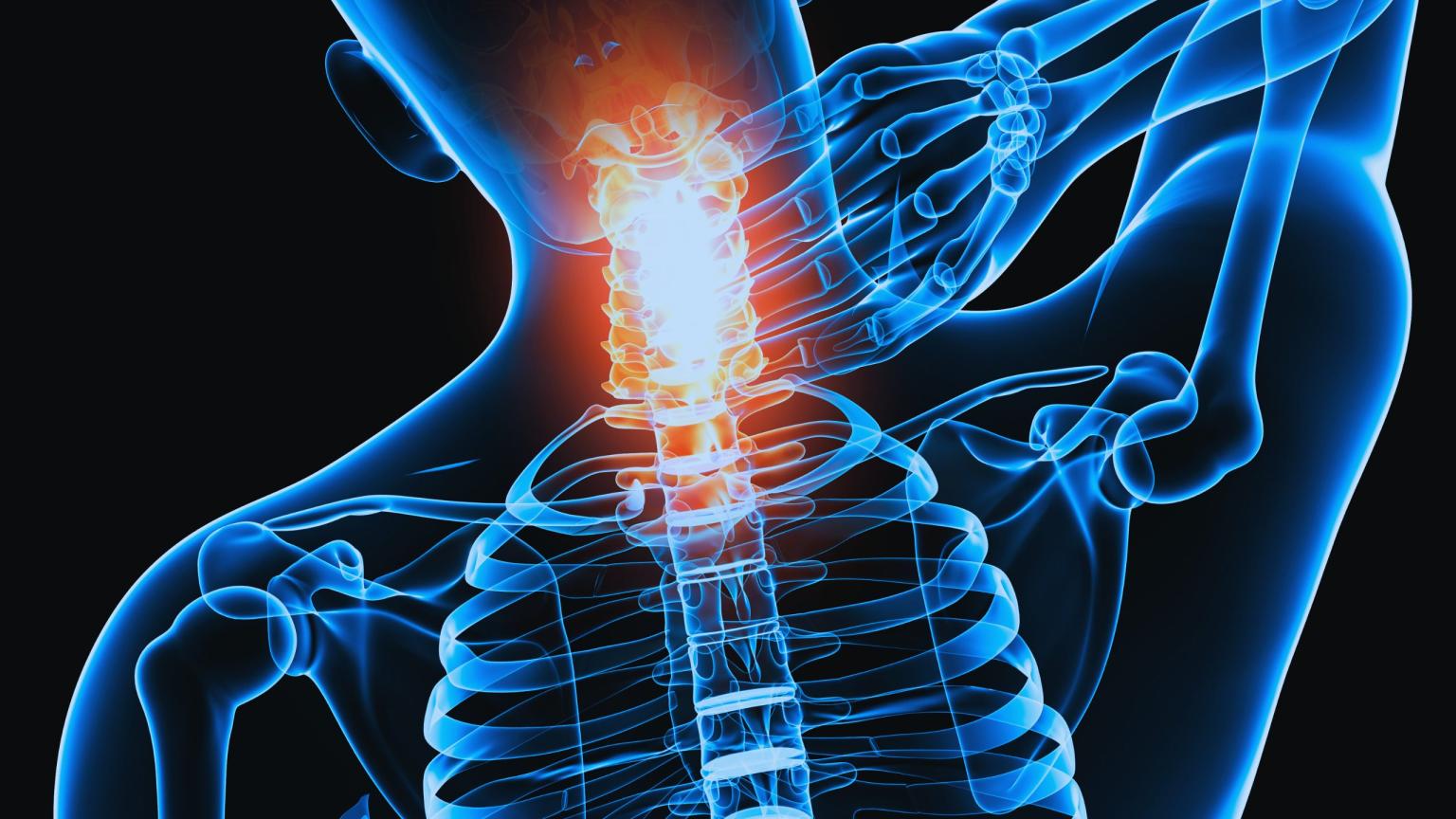 Understanding the 2024 Alberta Minor Injury Cap: What You Need to Know ...
